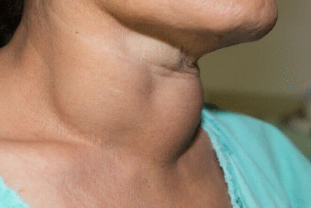 Expert Thyroid Care at Ekanshi Hospital: Balancing Hormones, Restoring Health