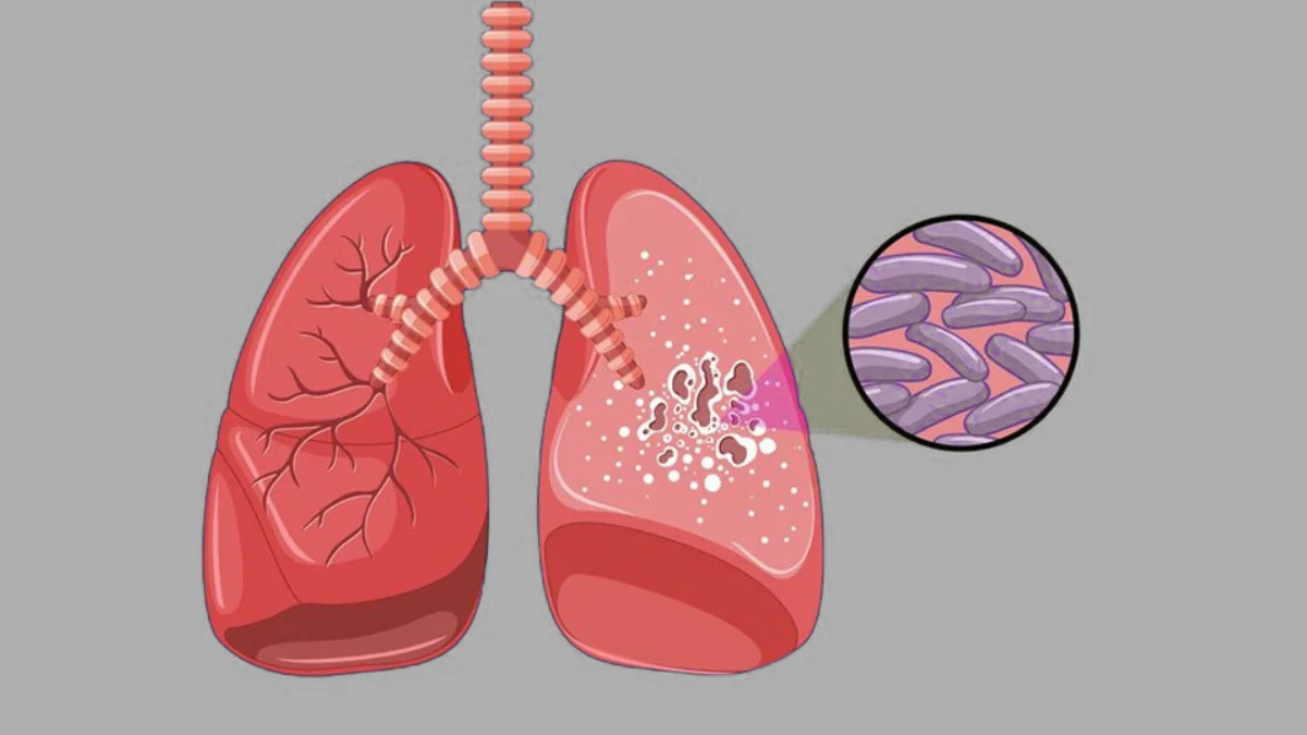 T.B. Treatment in Handewadi, Hadapsar
